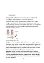 Referāts 'Vilsona slimība', 11.