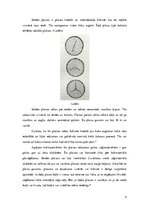 Prezentācija 'Serdes plaisas un spraugas', 4.