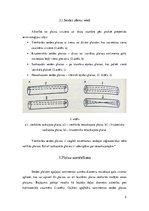 Prezentācija 'Serdes plaisas un spraugas', 5.