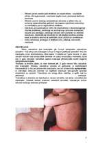 Konspekts 'Bērnu infekcijas slimības, kas noris ar izsitumiem', 8.