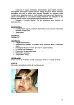 Konspekts 'Bērnu infekcijas slimības, kas noris ar izsitumiem', 13.