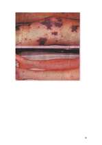 Konspekts 'Bērnu infekcijas slimības, kas noris ar izsitumiem', 14.