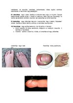 Konspekts 'Nagu slimības', 2.