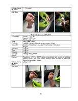 Referāts 'Trombocītiem bagātinātas plazmas un fibrīna pielietošana diabētiskās čūlas aprūp', 43.