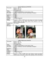 Referāts 'Trombocītiem bagātinātas plazmas un fibrīna pielietošana diabētiskās čūlas aprūp', 44.