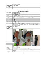 Referāts 'Trombocītiem bagātinātas plazmas un fibrīna pielietošana diabētiskās čūlas aprūp', 45.