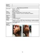 Referāts 'Trombocītiem bagātinātas plazmas un fibrīna pielietošana diabētiskās čūlas aprūp', 53.