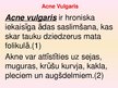 Prezentācija 'Patstāvīgais darbs ādas slimībās. Acne vulgaris', 2.