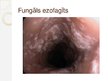 Prezentācija 'Nerefluksa ezofagīti', 8.