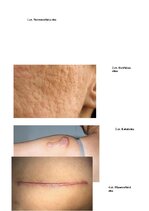 Referāts 'Rētas', 7.