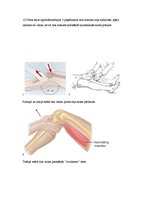 Referāts 'Priekšējās krusteniskās saites un meniska plīsuma ārstēšana', 5.