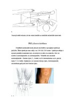 Referāts 'Priekšējās krusteniskās saites un meniska plīsuma ārstēšana', 6.