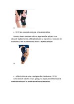 Referāts 'Priekšējās krusteniskās saites un meniska plīsuma ārstēšana', 13.