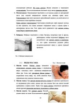 Referāts 'Физиотерапия', 16.