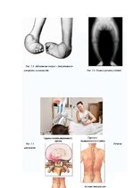 Referāts 'Физиотерапия', 40.