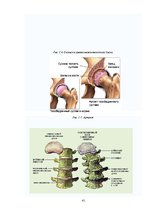 Referāts 'Физиотерапия', 41.