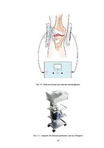 Referāts 'Физиотерапия', 47.