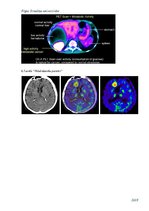 Referāts 'Pozitronu emisijas tomogrāfijas darbības principi', 8.