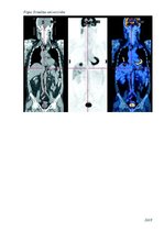 Referāts 'Pozitronu emisijas tomogrāfijas darbības principi', 9.