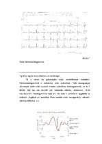 Diplomdarbs 'Funkcijas uzdošana grafiski', 47.