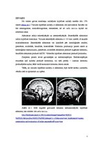 Referāts 'Hipofīzes audzēji', 3.