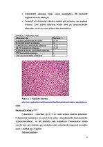 Referāts 'Hipofīzes audzēji', 6.