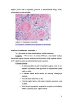 Referāts 'Hipofīzes audzēji', 8.