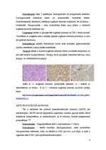 Referāts 'Hipofīzes audzēji', 9.