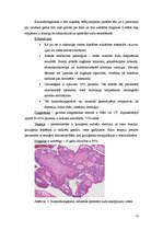 Referāts 'Hipofīzes audzēji', 11.