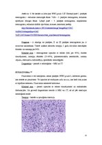 Referāts 'Hipofīzes audzēji', 13.