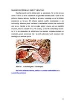 Referāts 'Hipofīzes audzēji', 15.