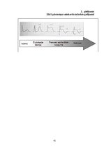 Referāts 'Miokarda infarkta attīstības riska faktori', 42.
