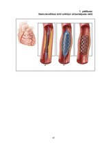 Referāts 'Miokarda infarkta attīstības riska faktori', 45.