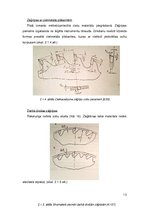 Konspekts 'Kokmateriālu piegriešana', 13.