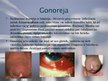Prezentācija 'Reproduktīvo orgānu slimības', 6.