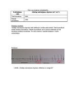 Paraugs 'Uzbudināmie audi. Skeleta muskuļi. Kontrakciju regulācija', 3.