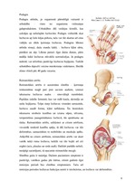 Konspekts 'Artrīts - slimība, kas jāārstē', 8.