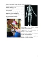 Konspekts 'Artrīts - slimība, kas jāārstē', 16.