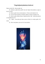 Konspekts 'Artrīts - slimība, kas jāārstē', 28.