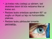 Prezentācija 'Redze', 14.
