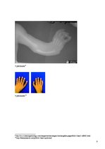 Konspekts 'Holta - Orama sindroms', 9.