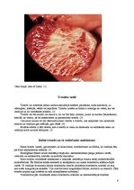 Referāts 'Tromboze, tās veidi', 6.