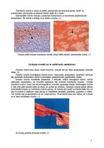 Referāts 'Tromboze, tās veidi', 7.