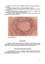 Referāts 'Tromboze, tās veidi', 11.