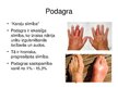 Prezentācija 'Podagra', 2.