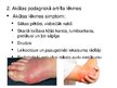 Prezentācija 'Podagra', 8.