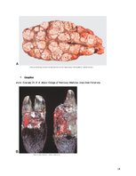 Referāts 'Nekroze', 26.