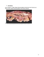 Referāts 'Nekroze', 27.