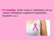 Prezentācija 'Krūts vēzis', 7.