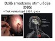 Prezentācija 'Dziļā smadzeņu stimulācija, izmantojot dzelzs oksīda nanodaļiņas', 2.